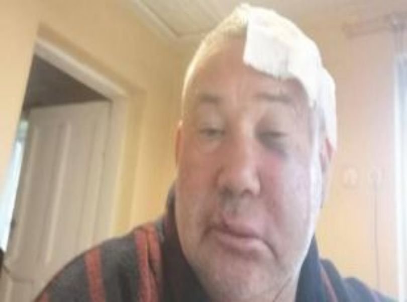 Разследват побой над селски кмет