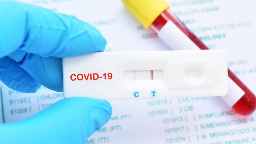 Сърбия разработва антигенен тест за COVID-19