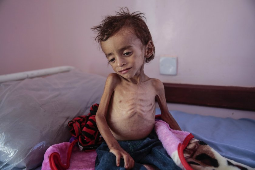7500 деца убити или ранени в Йемен
