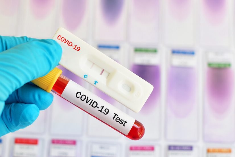 Турски тест за коронавируса дава 99% сигурност за 10 сек