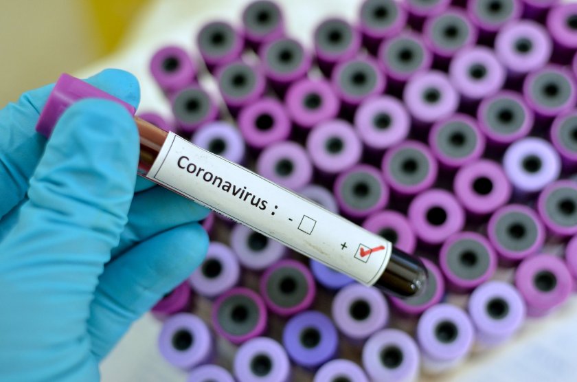 Рекорд: Близо 25 000 са новите случаи на коронавируса в Русия
