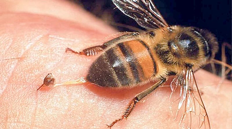 Първа помощ при ужилване от пчела 