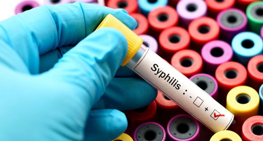 Болните от сифилис в Европа се увеличават