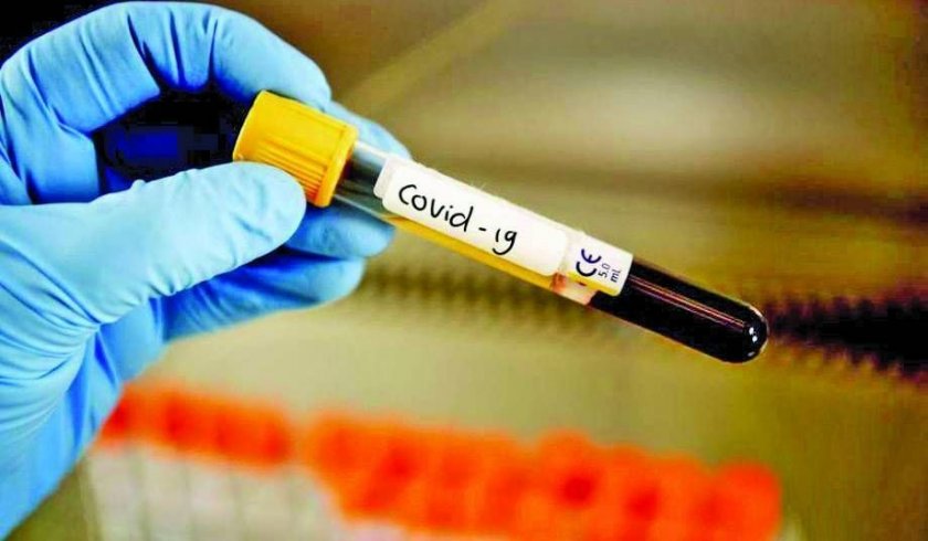 При 15 874 теста за ковид, направени у нас през