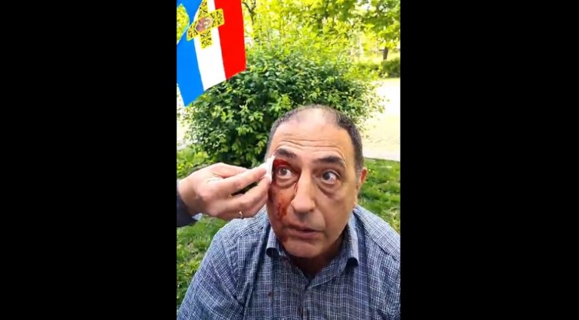 Лидерът на Възраждане Костадин Костадинов публикува видео с окървавен мъж.