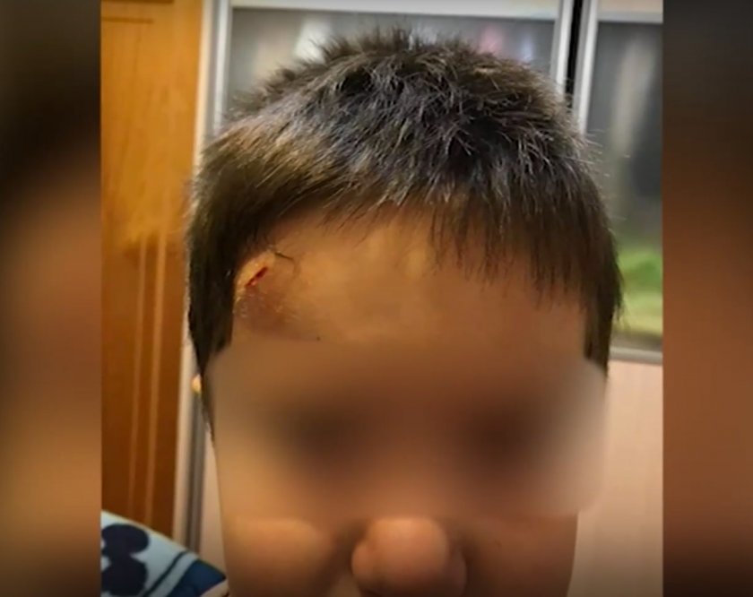 Хлапак заби молив в челото на дете в забавачка