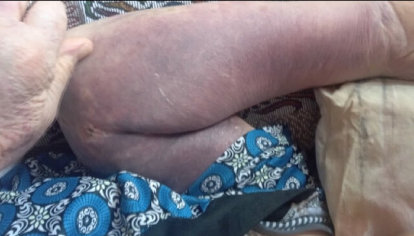 84-годишна старица връзвана и бита във врачанската болница (СНИМКИ)