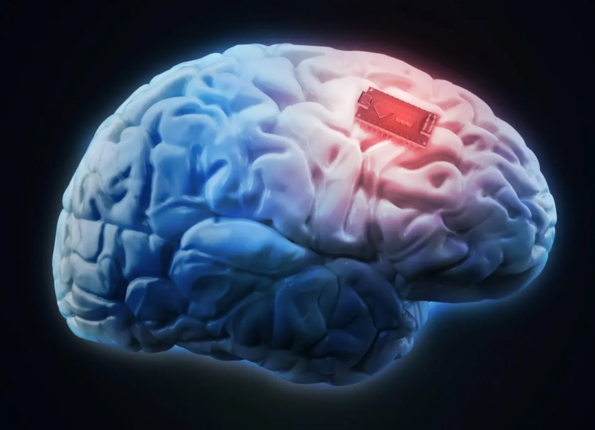 Китайци имплантираха чип в мозъка, без да дупчат черепа