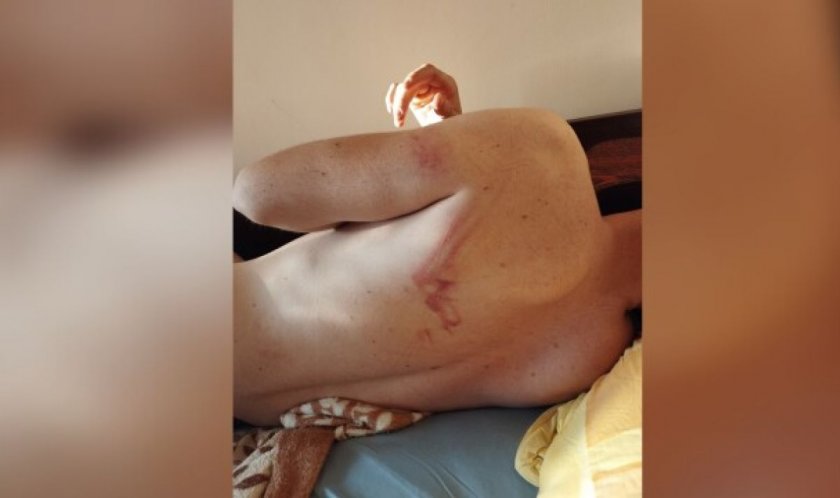 Млад мъж се оплака от полицейско насилие в Козлодуй