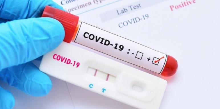 1496 са новите случаи на COVID-19 у нас, регистрирани за