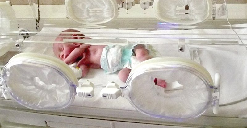 Лекари се борят 144 дни за живота на 540-грамово бебе