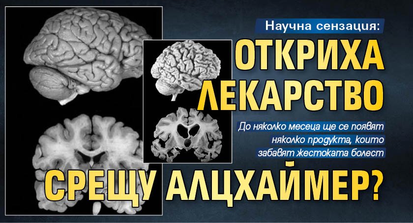 Научна сензация: Откриха лекарство срещу Алцхаймер?