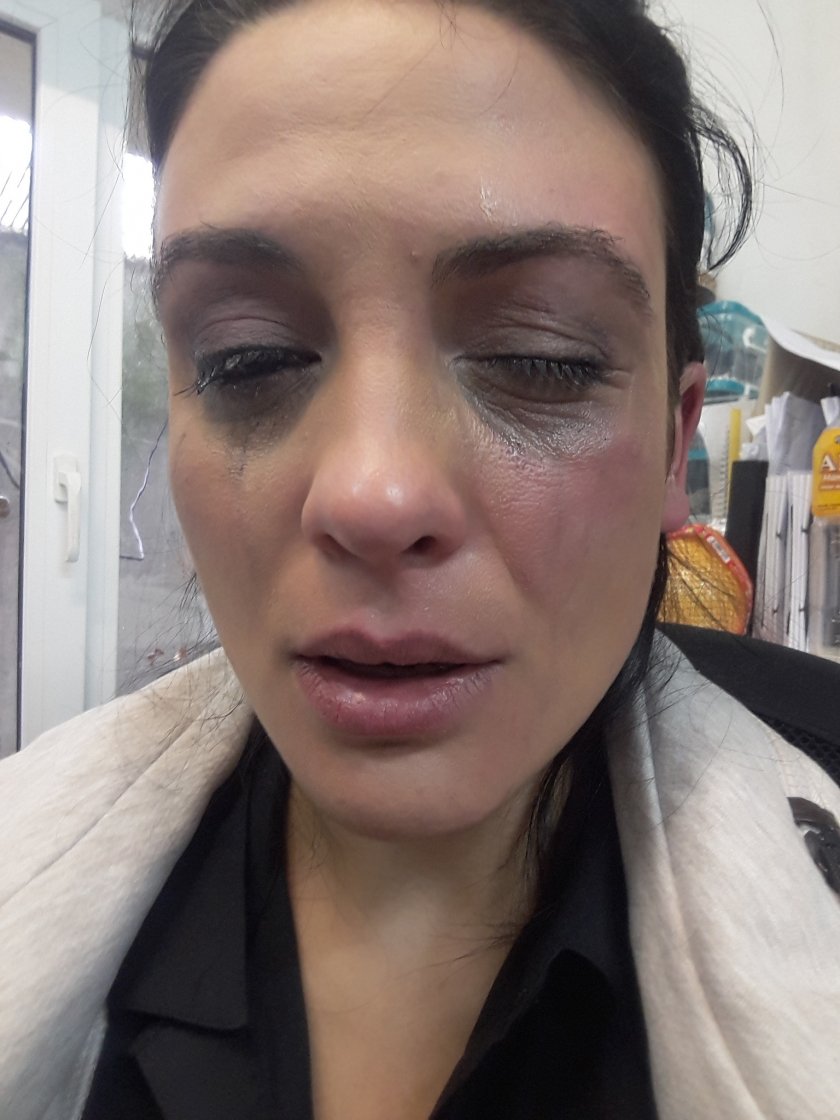 Актрисата Диана Димитрова е била жертва на насилие. Това разказа