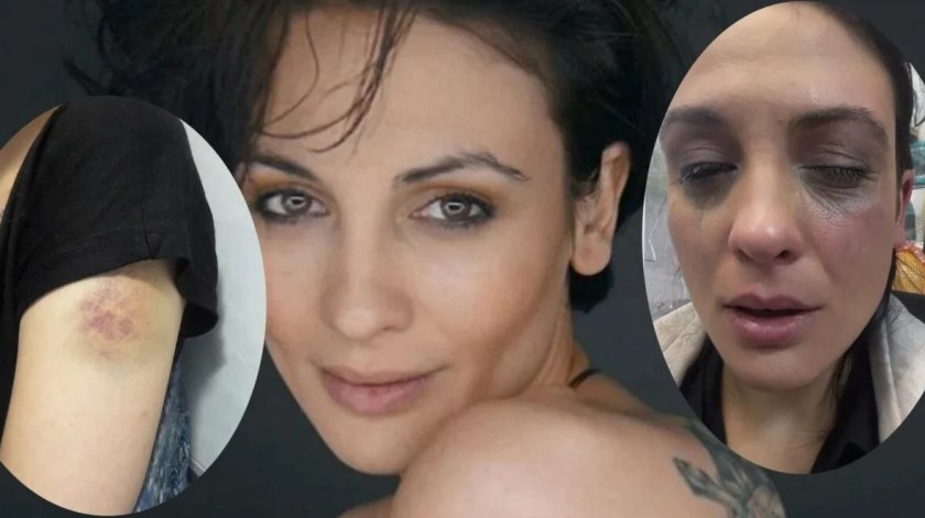 Сагата с насилието над актрисата Диана Димитрова продължава. След като