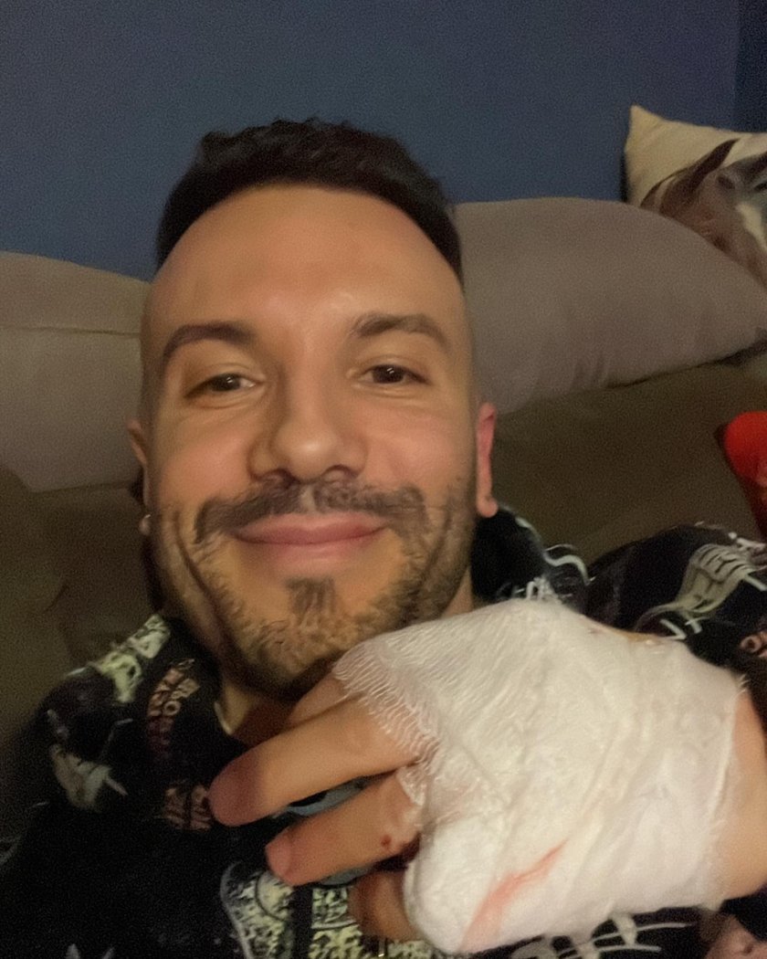 Фолк певецът Крум съобщи, че е претърпял инцидент, заради който