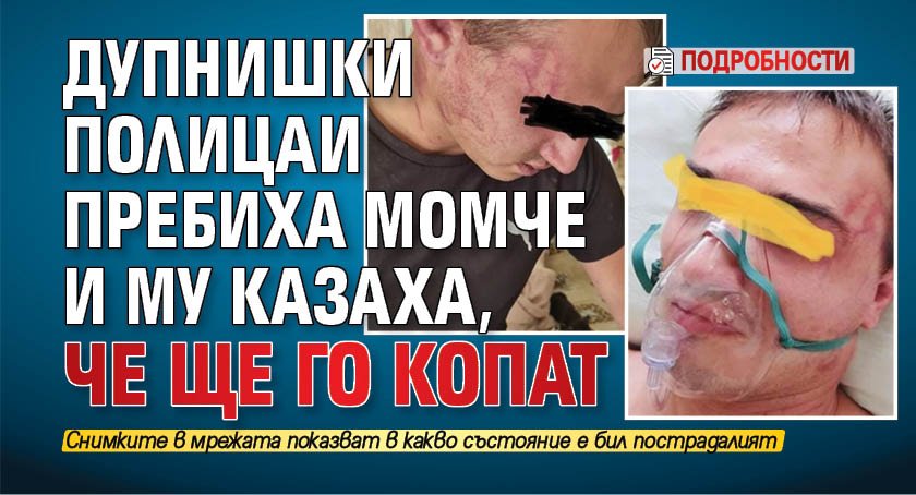 Дупнишки полицаи пребиха момче и му казаха, че ще го копат (ПОДРОБНОСТИ)