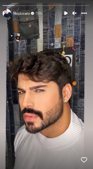 Фики Стораро вече е с нов нос. Суетният певец наскоро