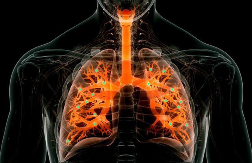 Създадоха наночастици, способни да редактират гени в белите дробове