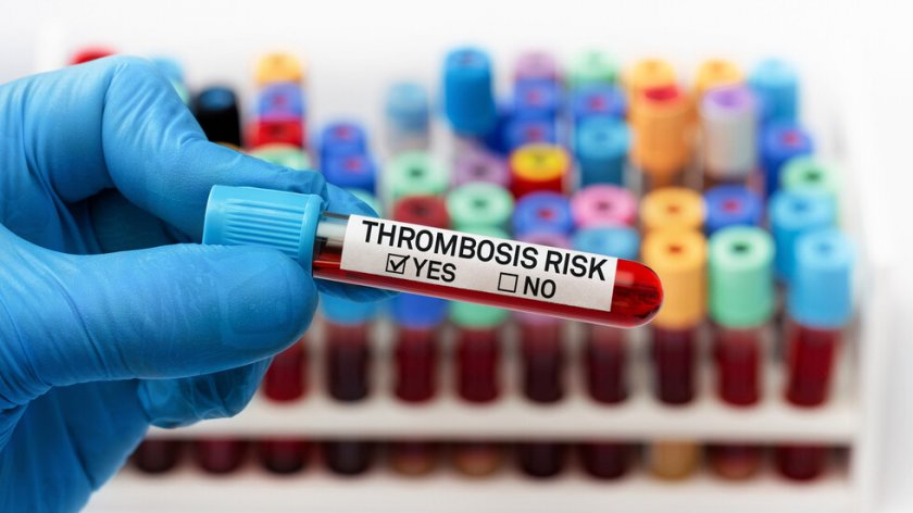 Учени създадоха препарат срещу образуване на тромби