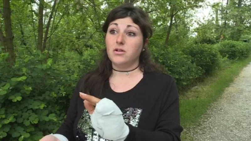 Бременната жена с отхапани от пони пръсти разказа за ужаса
