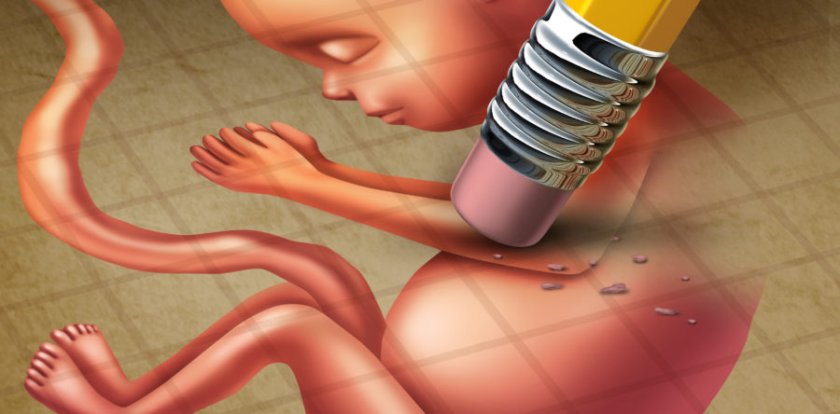 Средно по около 48 аборта у нас се правят всеки