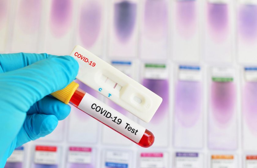 Завишение на пациентите със симптоми на грип и коронавирус в Ямбол
