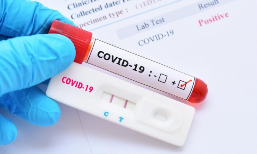 Новите случаи на КОВИД-19, регистрирани за последните 24 часа, са