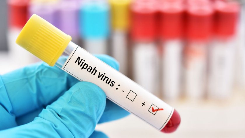 Тестват първата в света ваксина срещу вируса нипа