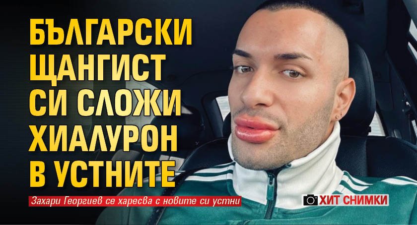 Български щангист си сложи хиалурон в устните (ХИТ Снимки)