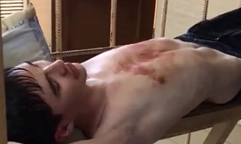 Непълнолетно момче пострада при побой в Благоевградско