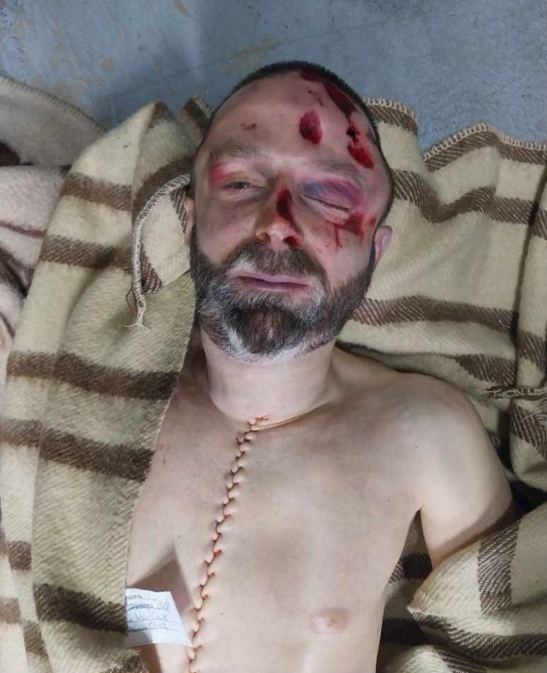 Шокираща снимка на застреляния миналата сряда пред дома си Мартин