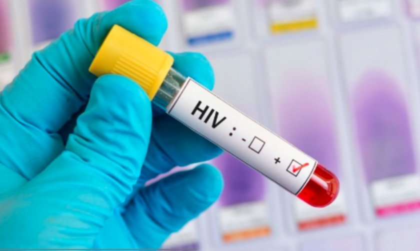 Лекар: 170 души у нас са болни и от ХИВ и от сифилис