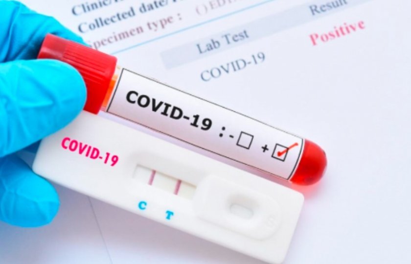 Не са регистрирани нови случаи на COVID-19 в България през