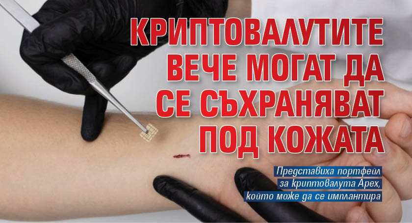 Криптовалутите вече могат да се съхраняват под кожата