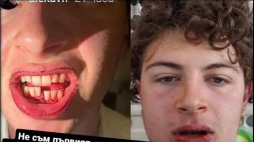 Мъжът, счупил челюстта на младеж на плаж Градина, е полицай