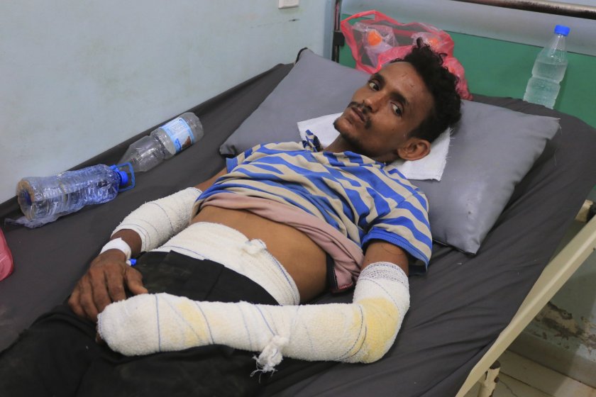 80 човека са с изгаряния след израелския удар по Йемен, хусите отвърнаха на атаката