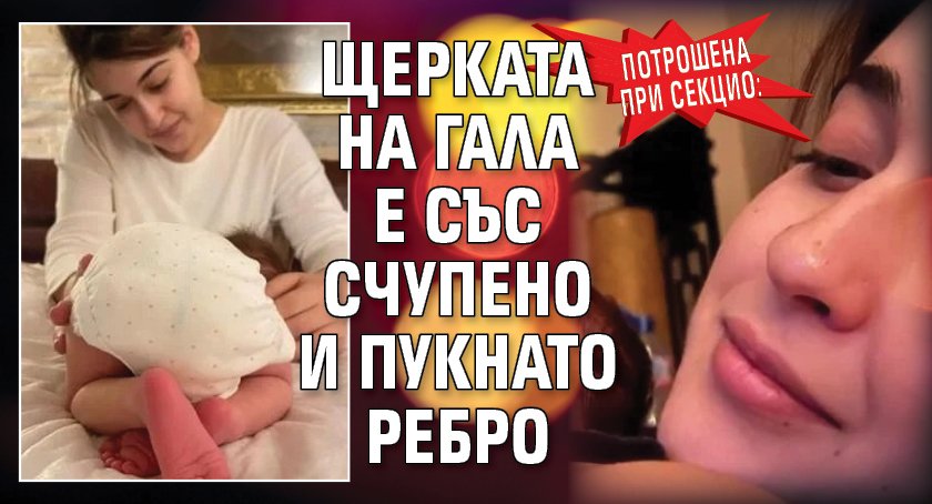 Потрошена при секцио: Щерката на Гала е със счупено и пукнато ребро 