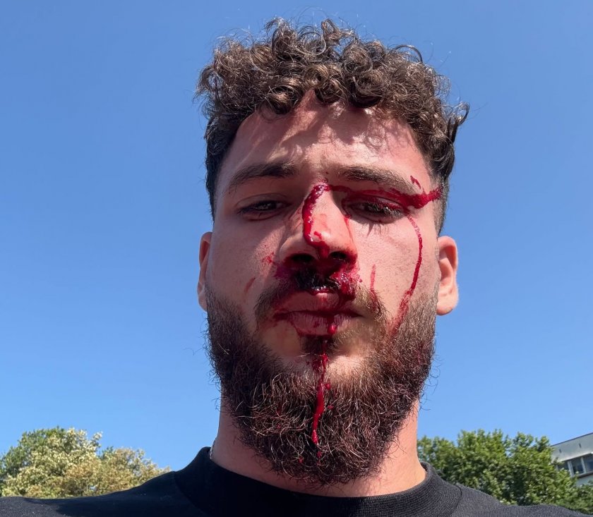 Кикбоксьор е бил размазан от бой в София, научи Lupa.bg.