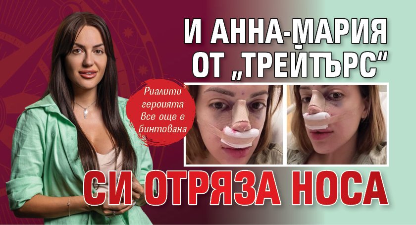 И Анна-Мария от „Трейтърс“ си отряза носа
