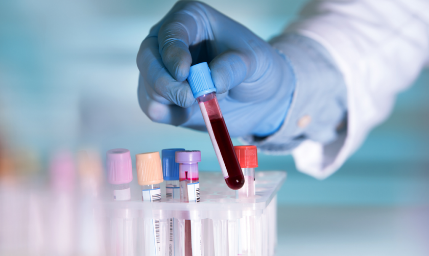 Великобритания откри стотици недиагностицирани случаи на ХИВ и хиляди на хепатит