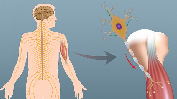 Откриха вируса, причиняващ детски паралич, в канализация в Германия