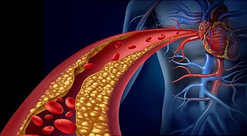 Генна терапия озаптява „лошия“ холестерол