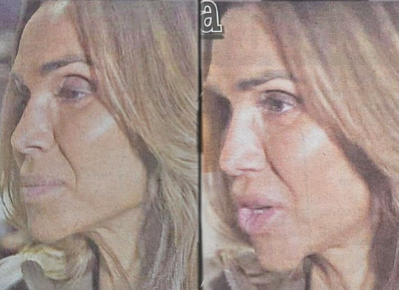 Шок-снимки: Ивайла Бакалова се обезобрази с ботокс