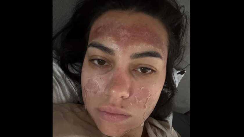 30-годишна жена завърши в спешното на Пирогов с втора степен