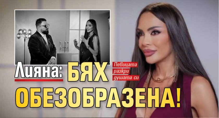 Лияна: Бях обезобразена!