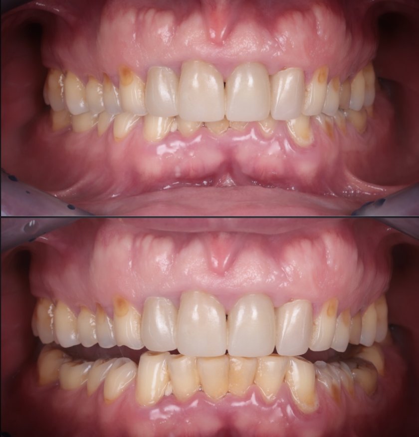 ЗОВ ЗА ПОМОЩ: Търси се чене за Иво Димчев!
