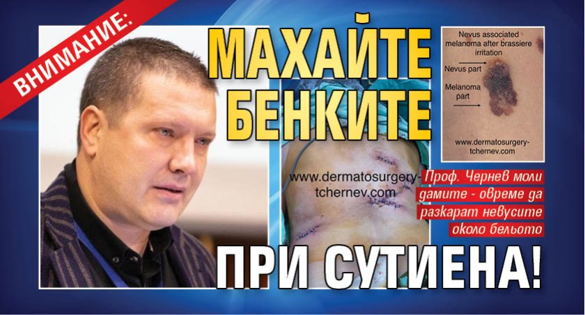 ВНИМАНИЕ: Махайте бенките при сутиена!