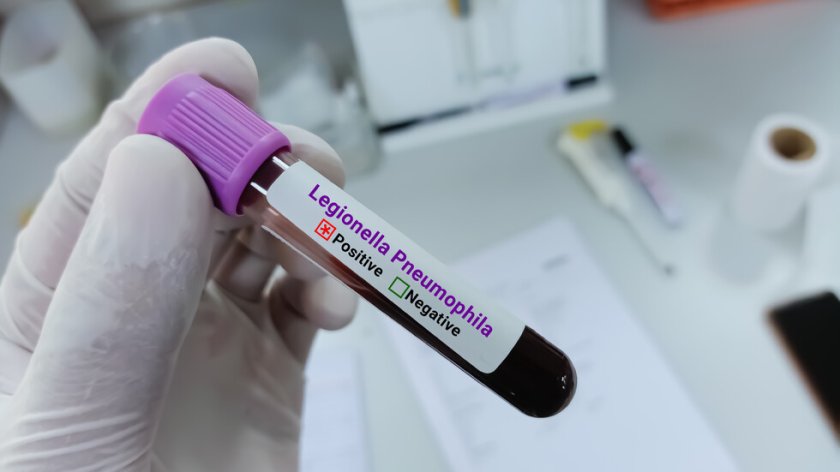 Жена от Бургас почина от легионерска болест