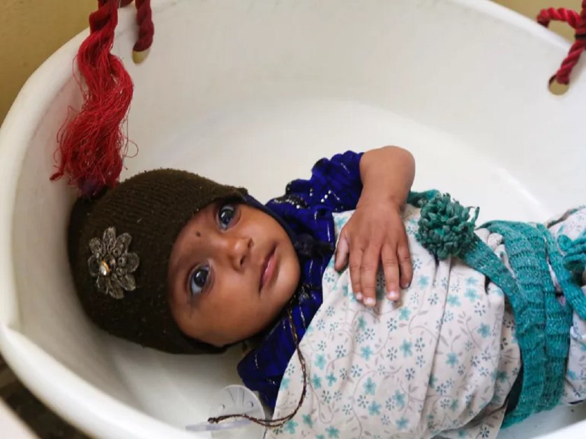 Дебили, ваксинирайте си децата. От морбили се мре!