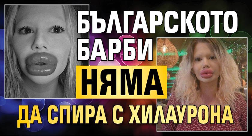 Българското Барби няма да спира с хилаурона